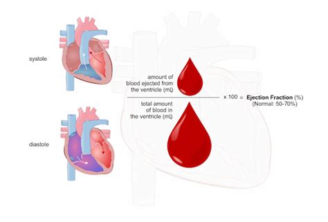 How to Calculate Ejection Fraction .